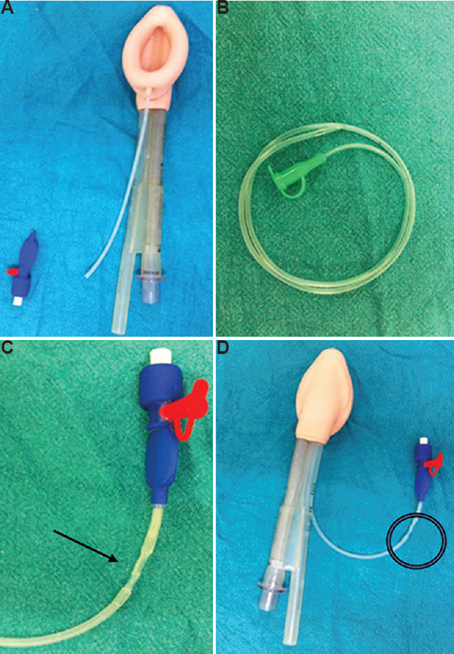 (A) PLMA with damage to inflation line. (B) Size 6 Fr feeding tube. (C) Feeding tube inserted within damaged ends of inflation line, secured with resin sealant (arrow). (D) Well-inflated functional PLMA after intervention.